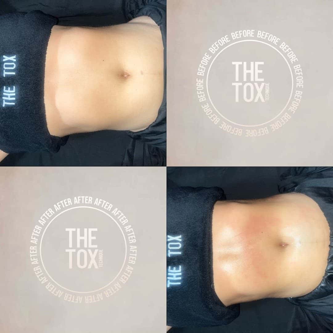 The Tox Henderson — Chiropractors & Therapy photo 3 of 5